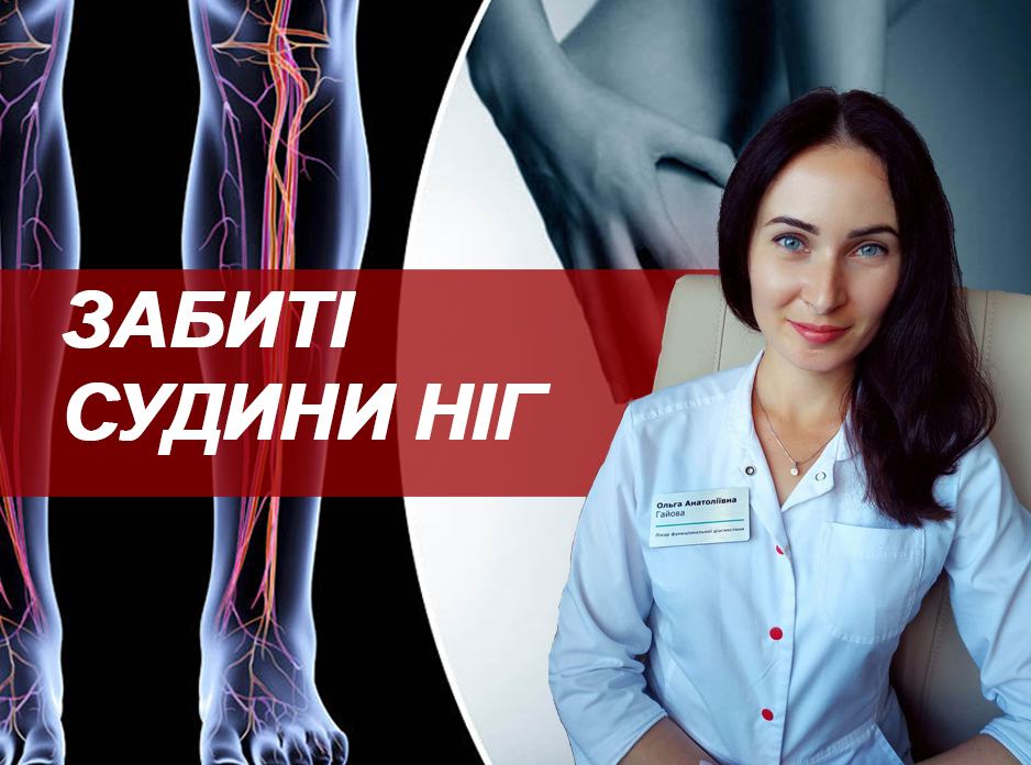 Забиті судини ніг
